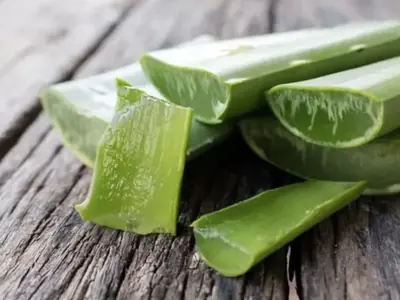 Aloe Vera untuk Kulit Terbakar